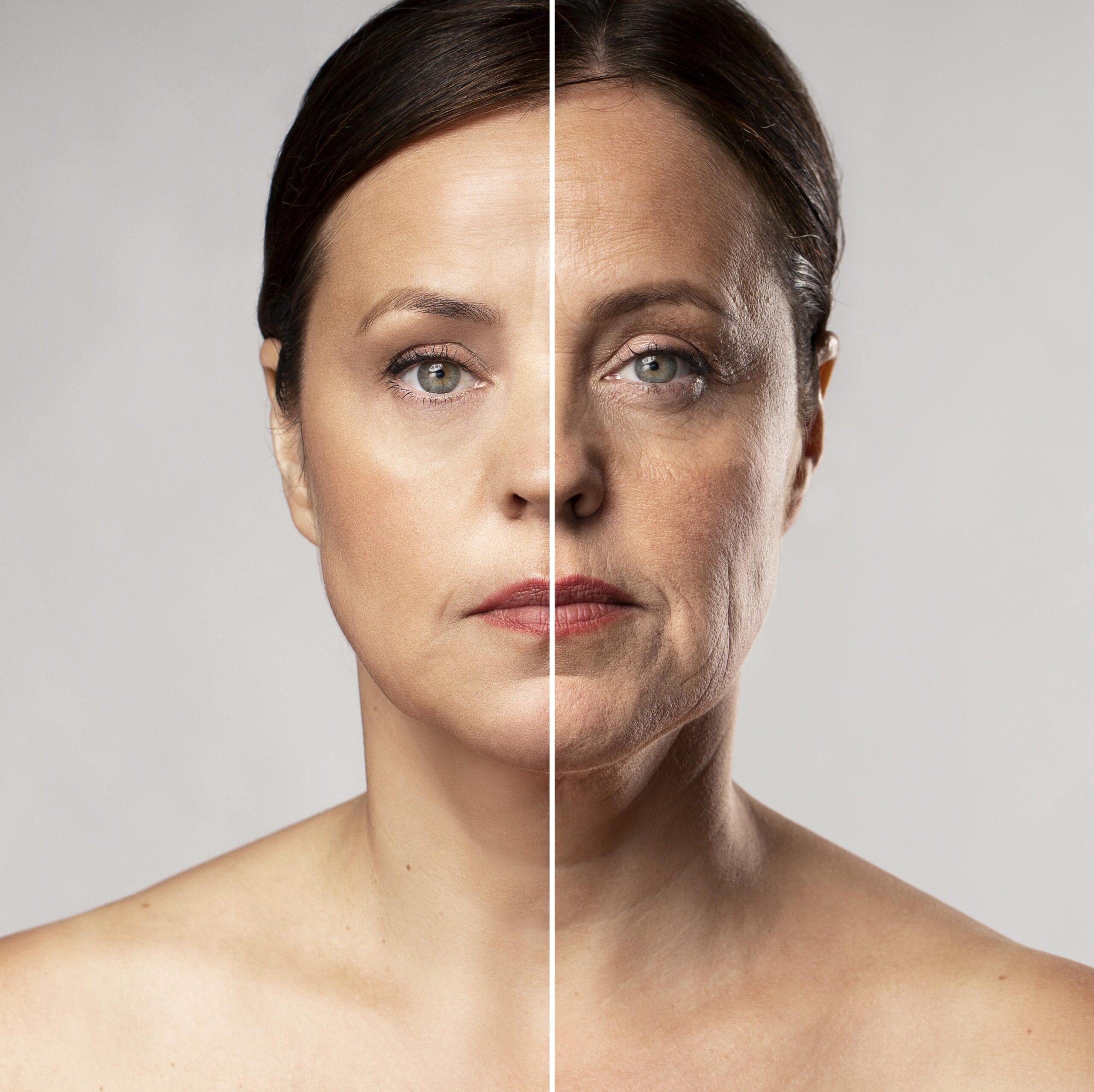  Toxina botulínica: Qual sua função na Odontologia?